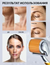 TDK-047 Мезороллер ZGTS в тубусе 192 игл 0,5 мм