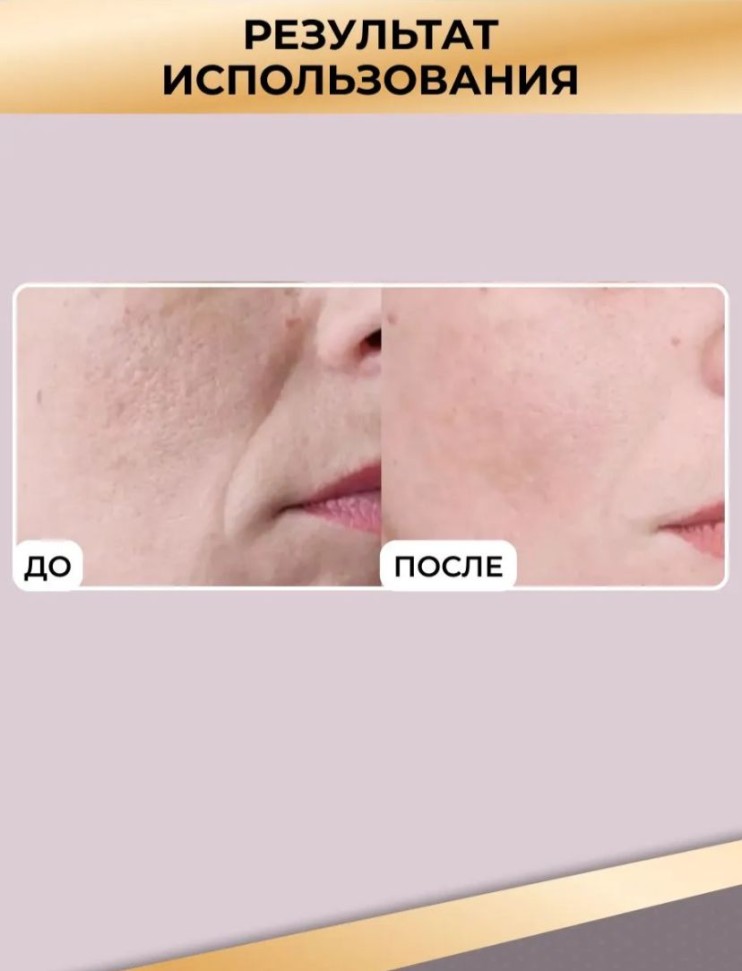 TDK-047 Мезороллер ZGTS в тубусе 192 игл 0,5 мм