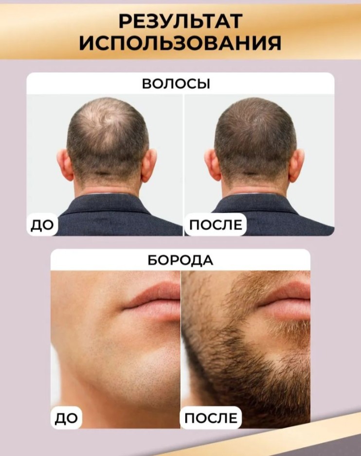 TDK-047 Мезороллер ZGTS в тубусе 192 игл 0,5 мм