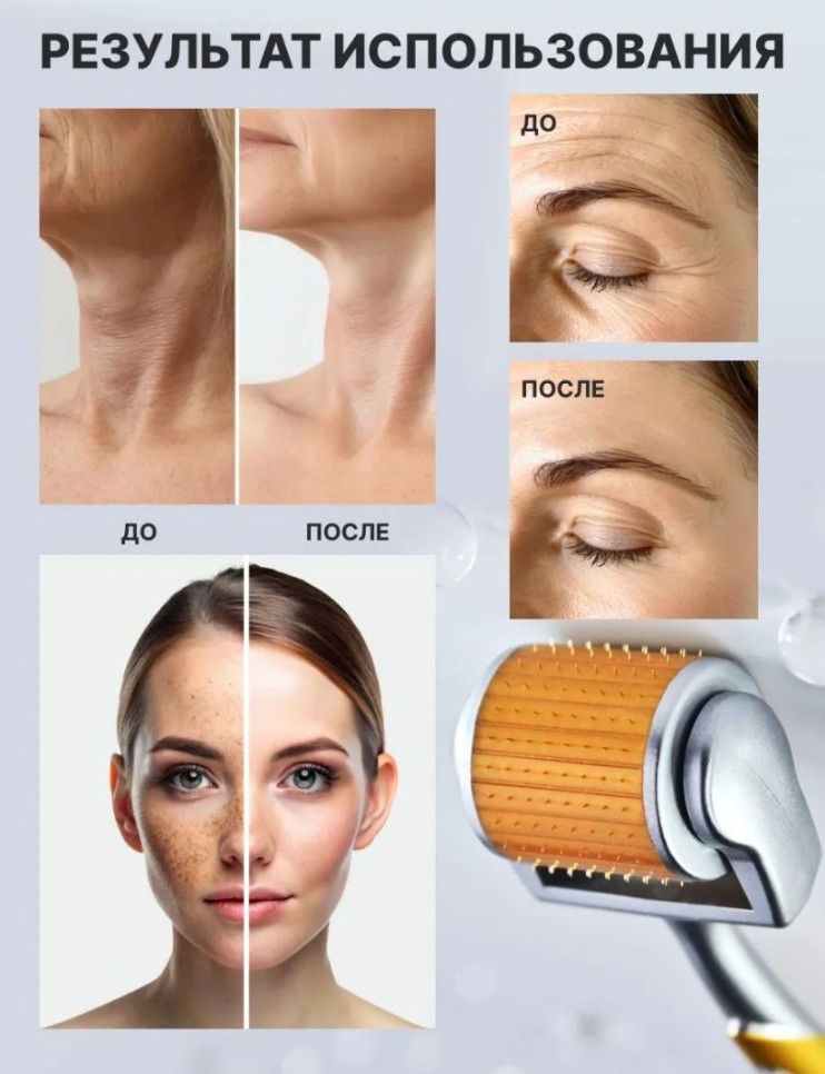 TDK-050 Мезороллер  ZGTS в тубусе 192 иглы 0.75 мм